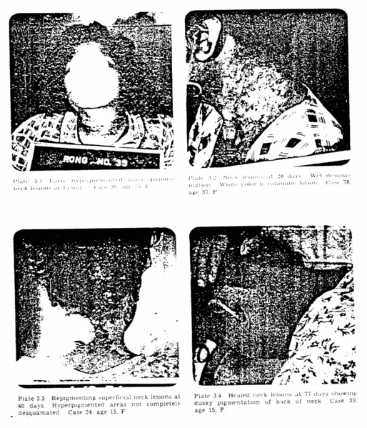 514px-Project_4.1_figures